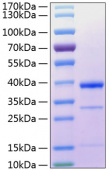 Active Recombinant Human Cathepsin S Protein (RP00181)