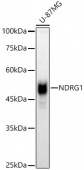 [KO Validated] NDRG1 Rabbit pAb (A2142)
