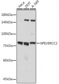 XPD/ERCC2 Rabbit mAb (A19241)