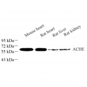 Anti -Acetylcholinesterase Rabbit pAb