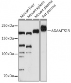 ADAMTS13 Rabbit mAb (A3370)