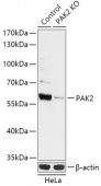 [KO Validated] PAK2 Rabbit pAb (A18093)