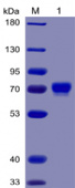 Recombinant Human Mesothelin/MSLN Protein (RP02250)