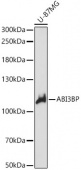 ABI3BP Rabbit pAb (A14581)