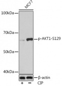 Phospho-AKT1-S129 Rabbit mAb (AP0981)