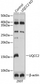 [KO Validated] UQCC2 Rabbit pAb (A19955)