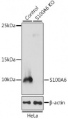 [KO Validated] S100A6 Rabbit pAb (A4104)