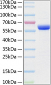 Active Recombinant Human MMP-3 Protein (RP00220LQ)