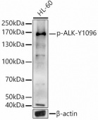 Phospho-ALK-Y1096 Rabbit pAb (AP0503)