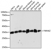 [One Step]YWHAZ Antibody Kit (RK05724)