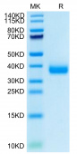 Recombinant SARS-CoV-2 Spike RBD(B.1.1.529/Omicron)  Protein (RP02107)