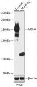 [KO Validated] MSH6 Rabbit pAb (A18007)