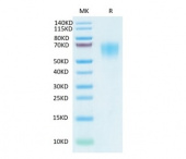 Recombinant SARS-COV-2 Spike S1 NTD Protein (RP02323)