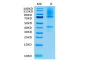 Biotinylated Recombinant Human Glypican-3/GPC3 Protein (RP02371)