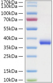 Recombinant SARS-COV-2 Spike RBD(N501Y)  Protein (RP01334)