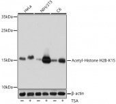 Acetyl-Histone H2B-K15 Rabbit pAb (A15622)