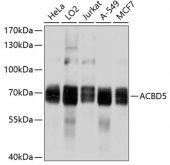 ACBD5 Rabbit pAb (A10595)