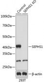 [KO Validated] SEPHS1 Rabbit pAb (A19919)