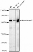 [KO Validated] Hexokinase II Rabbit mAb (A20829)