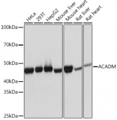 ACADM Rabbit mAb (A4567)