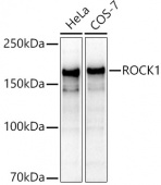 [KO Validated] ROCK1 Rabbit pAb (A1008)