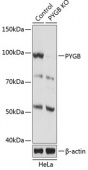 [KO Validated] PYGB Rabbit pAb (A19910)