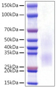 Recombinant Rat PD-1/PDCD1/CD279 Protein (RP01506)