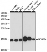 [KO Validated] NDUFB4 Rabbit pAb (A13820)