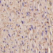 Anti -AKAP13/p47 Rabbit pAb