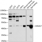 A4GALT Rabbit pAb (A8817)