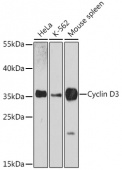 [KO Validated] Cyclin D3 Rabbit pAb (A0746)