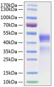 Active Recombinant Human IL-12A&IL-12B Protein (RP01232)