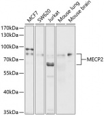 [KO Validated] MECP2 Rabbit pAb (A0707)