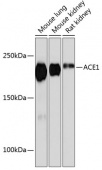 ACE1 Rabbit mAb (A11357)