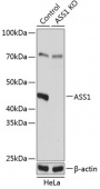[KO Validated] ASS1 Rabbit pAb (A19878)