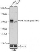 [KO Validated] TRK fused gene (TFG) Rabbit pAb (A19858)