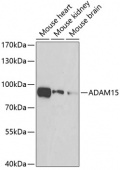 ADAM15 Rabbit pAb (A7756)