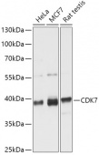 [KO Validated] CDK7 Rabbit pAb (A12942)