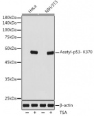Acetyl-p53- K370 Rabbit mAb (A19836)