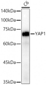[KO Validated] YAP1 Rabbit mAb (A19134)