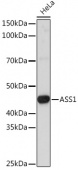 [KO Validated] ASS1 Rabbit pAb (A16767)