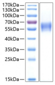 Recombinant Human CNTFR-alpha Protein (RP00242)