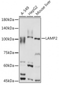 [KO Validated] LAMP2 Rabbit pAb (A14017)