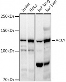 ACLY Rabbit pAb (A15251)