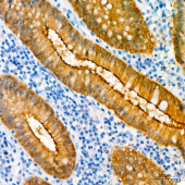 Villin1 Mouse mAb (A20545)