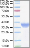 Recombinant Human FR-alpha/FOLR1 Protein (RP01379)