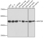 WNT2B Rabbit mAb (A19554)
