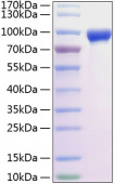 Recombinant Rat MMP-9 Protein (RP01212)