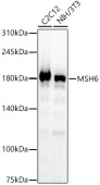 [KO Validated] MSH6 Rabbit mAb (A22652)