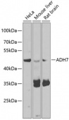 ADH7 Rabbit pAb (A7871)
